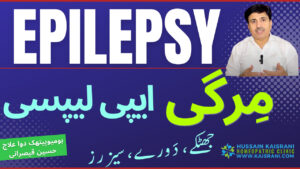 مرگی(ایپی لیپسی): مرض، تشخیص اور ہومیوپیتھک ادویات و علاج ۔ حسین قیصرانی۔