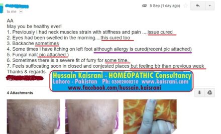 A Followup / Feedback from an ONLINE Client with Skin Allergy, Fungus, Fear and Phobia of closed places – Remarkable Improvement by the Grace of Allah!