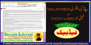 پتے کی پتھری، فیٹی لور ۔ ہومیوپیتھک علاج ۔ فیڈبیک