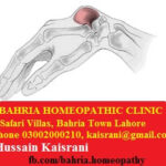 Homeopathic Treatment of Ganglion Cyst on Wrist – A Case of Causticum
