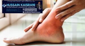 جوڑوں کے درد، اکڑاہٹ، سوزش، گنٹھیا، گاؤٹ، آرتھرائٹس – ہومیوپیتھک دوائیں اور علاج – حسین قیصرانی