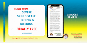 Curing from Severe Skin Problems with Dr. Hussain Kaisrani’s Online Homeopathic Treatment – Google Review
